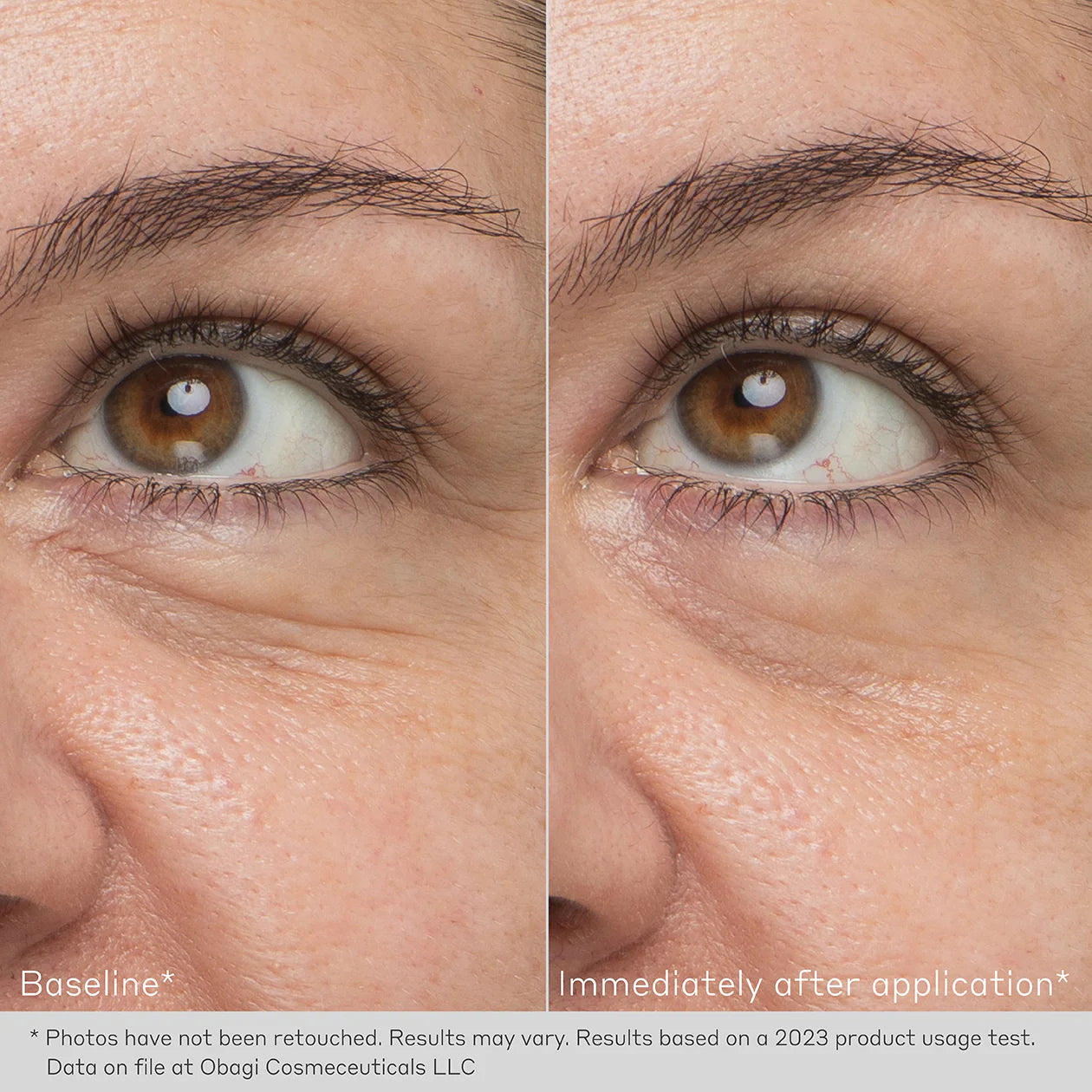 OBAGI Daily Hydro-Drops® REJUVENATING EYE GEL CREAM Brightening & Smoothing Eye Gel Cream