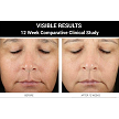FaceForward Advanced Retinol Serum 0.1%