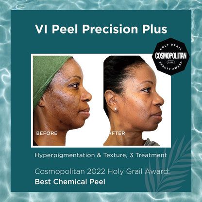 New Year, New Skin - VI Peel Special - Precision Plus