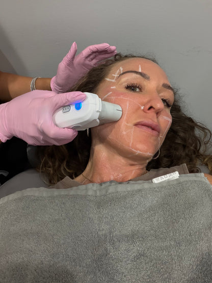 Hot Girl Lift - Ultherapy Prime — Lower Face (includes cheeks and upper neck) 35% Off