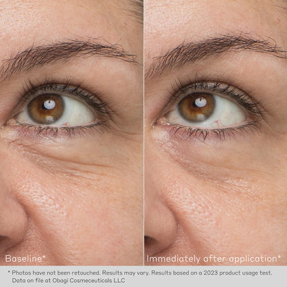 OBAGI Daily Hydro-Drops® REJUVENATING EYE GEL CREAM Brightening & Smoothing Eye Gel Cream