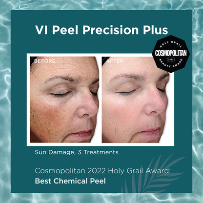 New Year, New Skin - VI Peel Special - Precision Plus